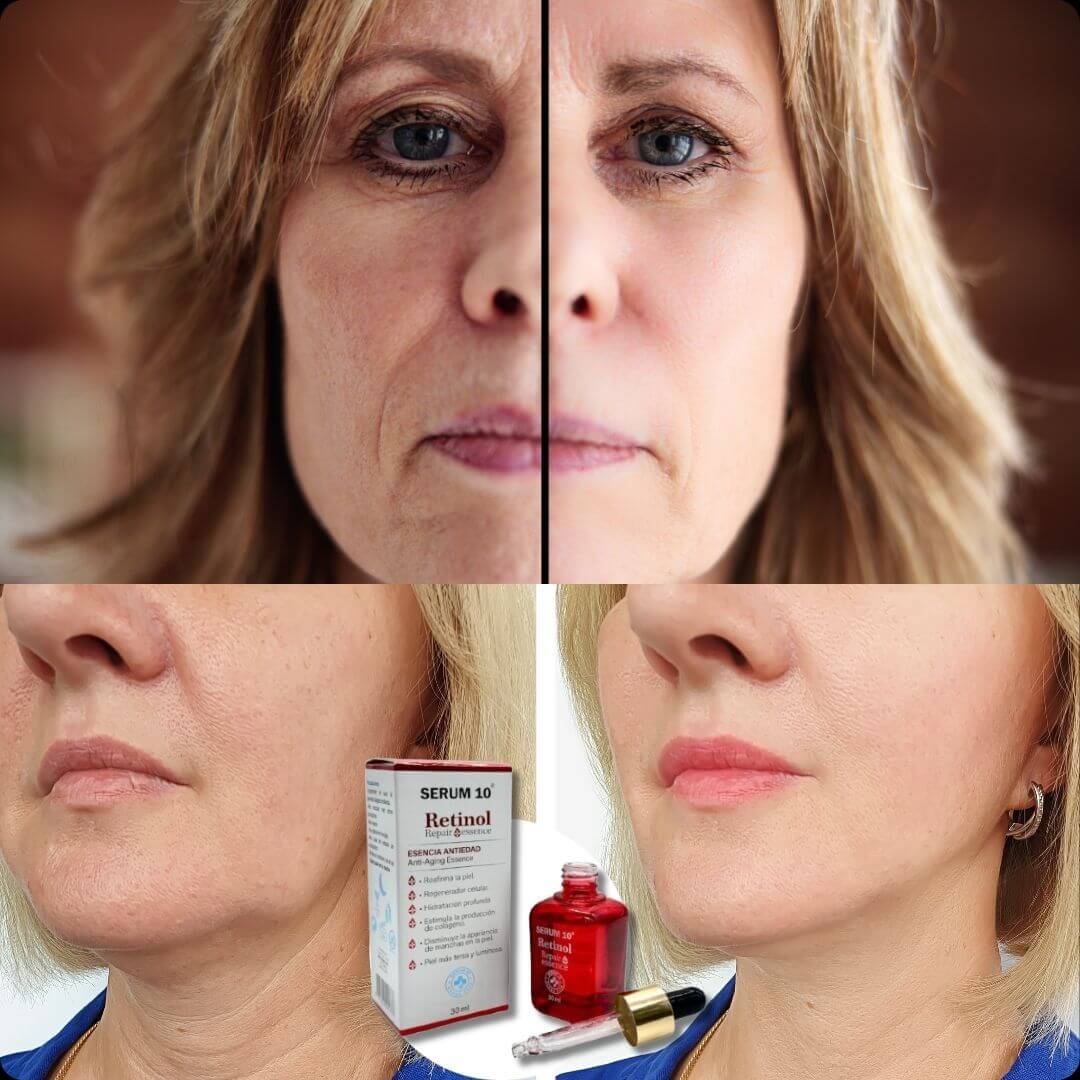 EternalGlow™ - ETERNA JUVENTUD CON REGISTRO INVIMA