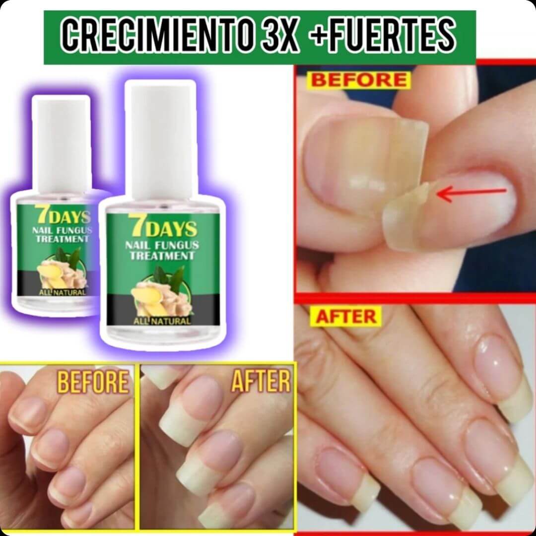 NailRevita Pro™ -Fortaleza y Crecimiento Superior para Tus Uñas