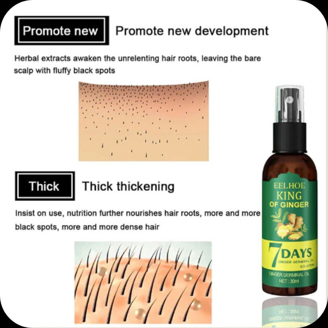 EELHOE King Of Ginger® Milagroso Elixir para el Cabello