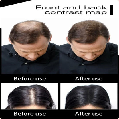 🤩 TOPPIK 🤩 Fibras Capilares con Keratina