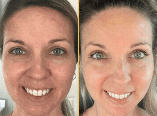 Colágeno Hidrolizado GlowVita® – Belleza total desde el interior